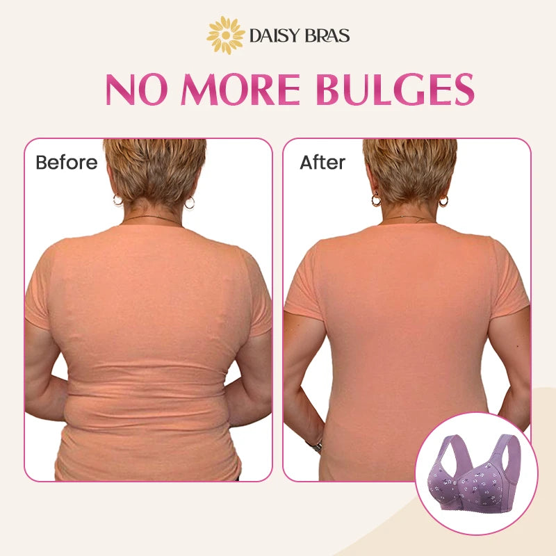 Daisy Bra - Comfortable & Convenient Front Button Bra